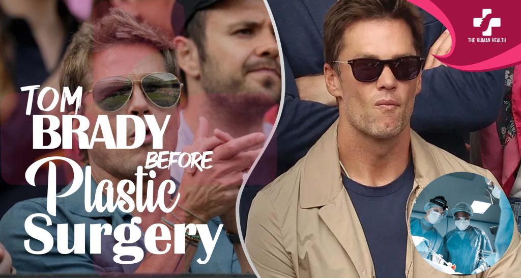 Tom Brady Before Plastic Surgery Revealed Now