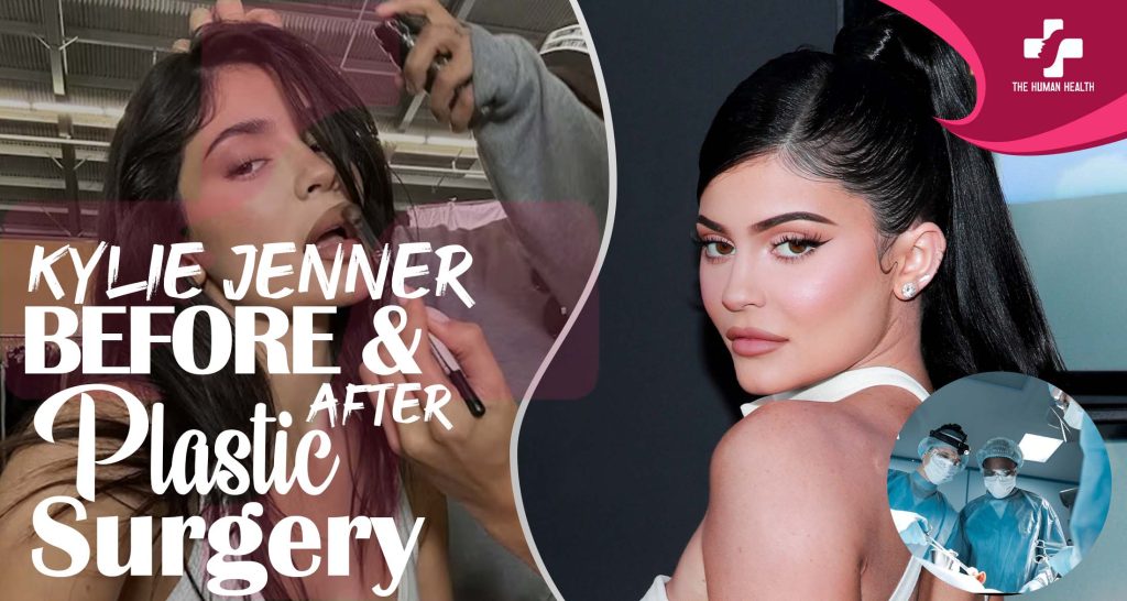 Kylie Jenner Plastic Surgery The Truth About.!