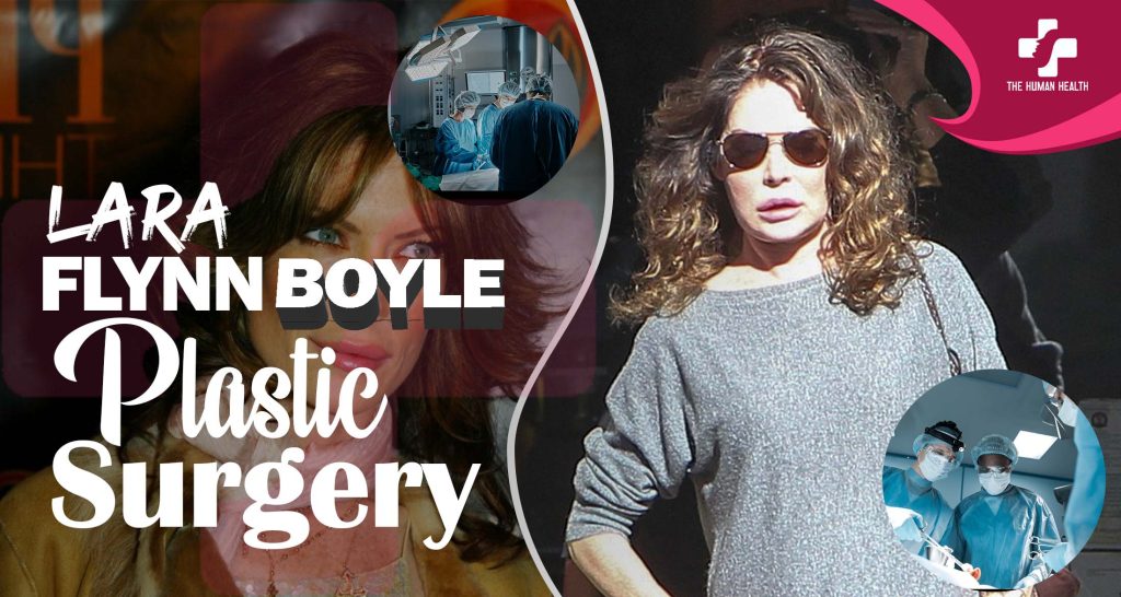 Lara Flynn Boyle Plastic Surgery Secrets Exposed