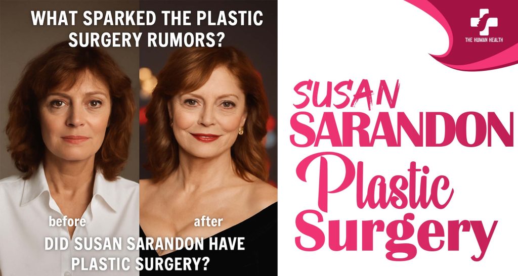 Susan Sarandon Plastic Surgery: Eye-Opening New Look