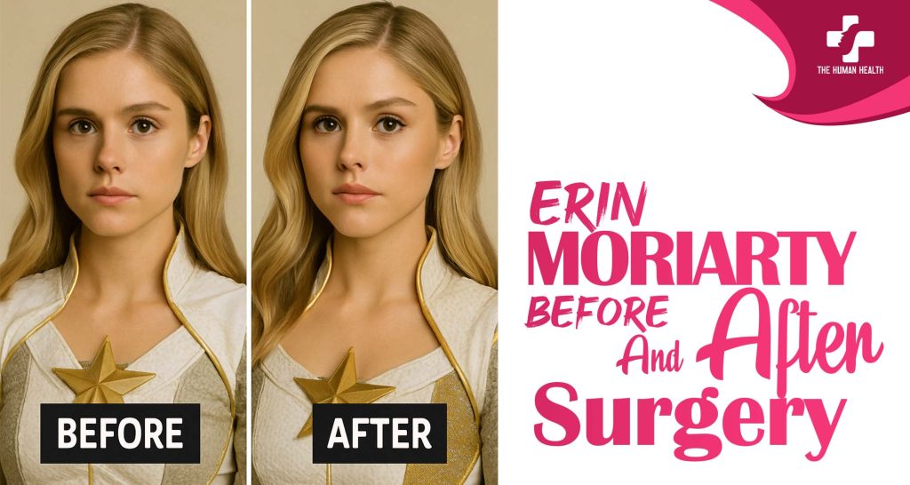 Erin Moriarty Before And After Surgery: Jaw-Dropping Secrets