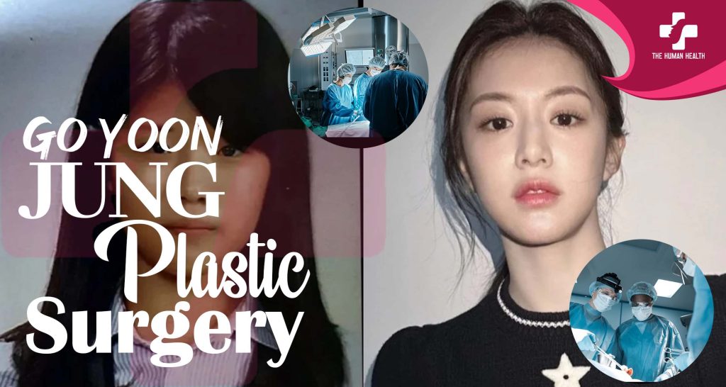 Go Yoon Jung Plastic Surgery Exposed: Shocking Secrets