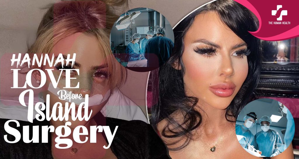 Hannah Love Island Before Surgery Exposed