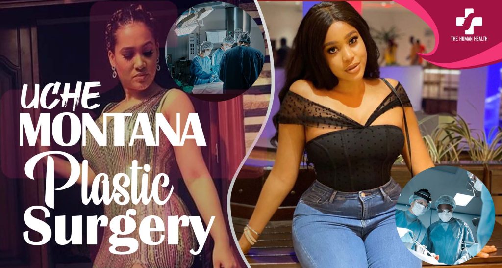 Uche Montana Surgery Secrets You Must Know
