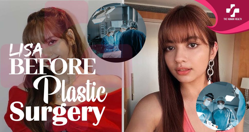 Lisa Before Plastic Surgery: Stunning Then & Now