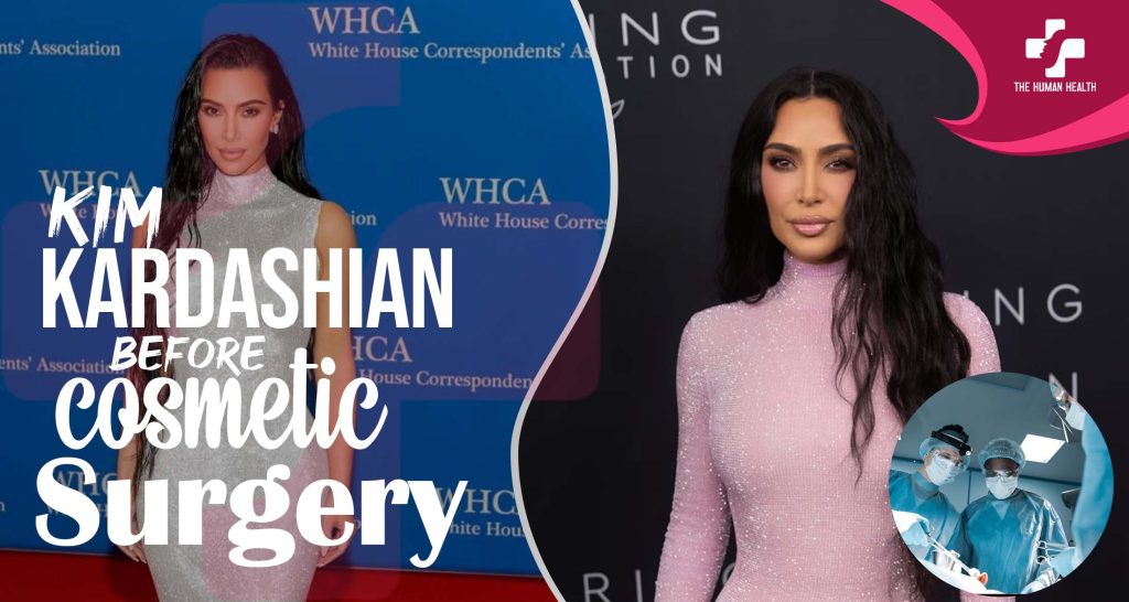 Kim Kardashian Before Surgery Exclusive Truth About?