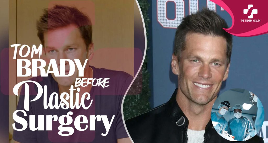 Tom Brady Before Plastic Surgery Revealed Now