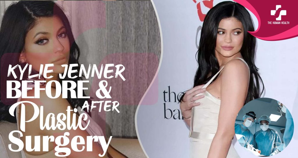 Kylie Jenner Plastic Surgery The Truth About.!