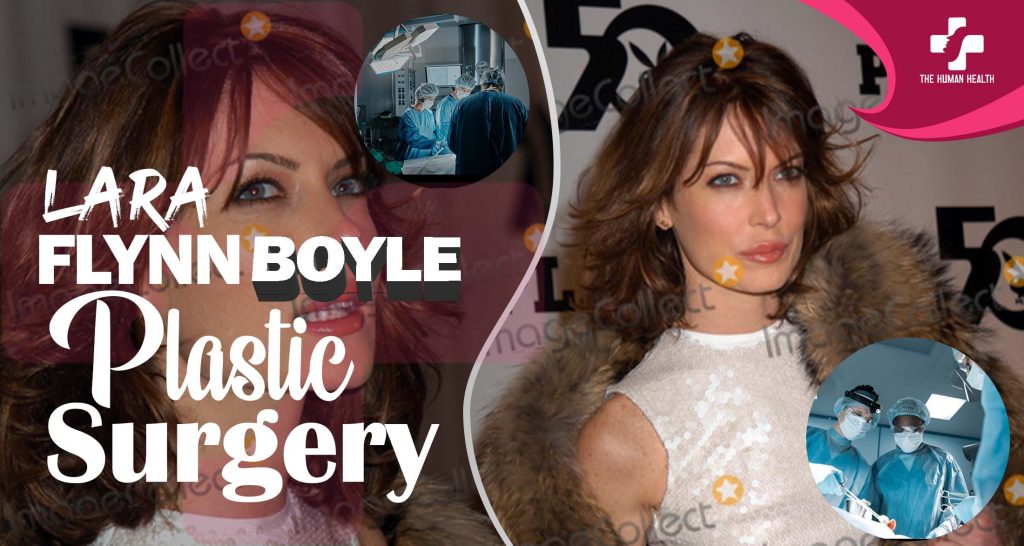 Lara Flynn Boyle Plastic Surgery Secrets Exposed
