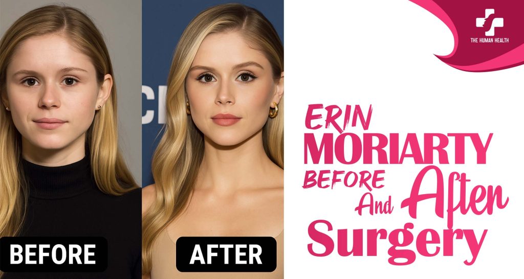 Erin Moriarty Before And After Surgery: Jaw-Dropping Secrets