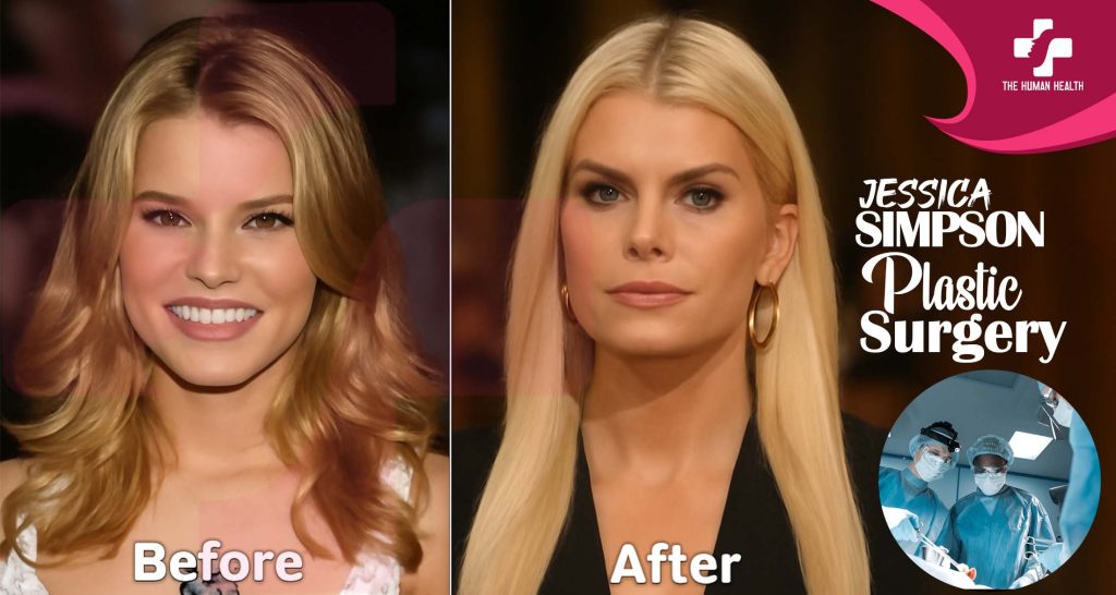 Jessica Simpson Plastic Surgery: What You Need To Know
