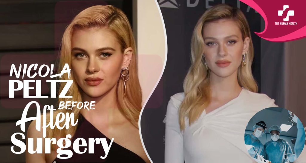 Nicola Peltz Before And After Surgery: Surprising, Remarkable, Genuine Secrets