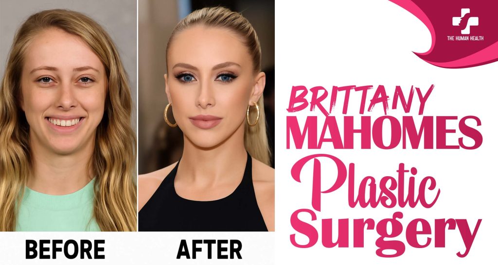 Brittany Mahomes Plastic Surgery: Eye-Opening New Look
