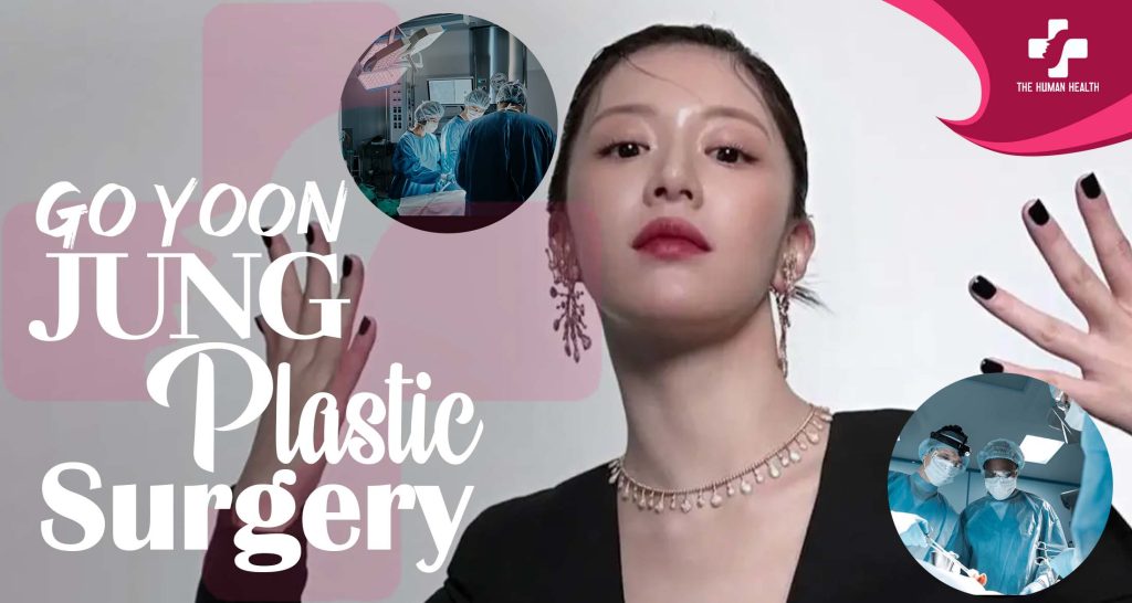 Go Yoon Jung Plastic Surgery Exposed: Shocking Secrets