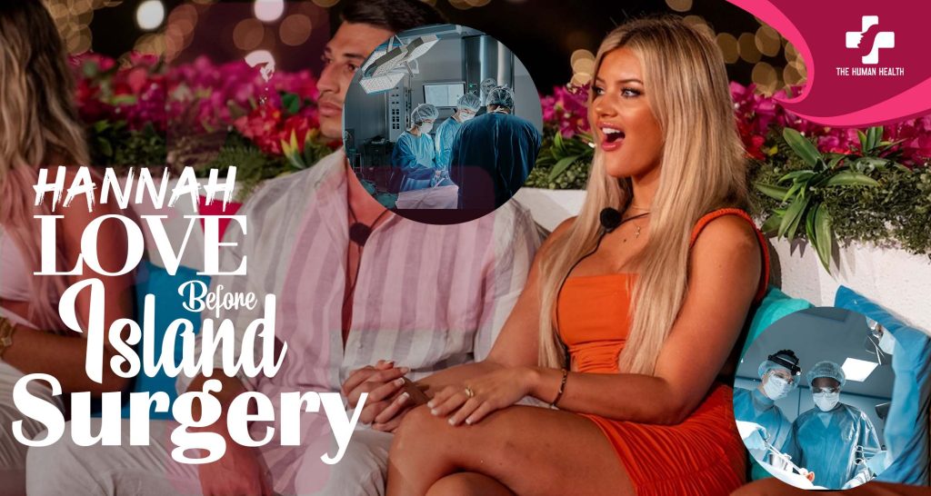 Hannah Love Island Before Surgery Exposed