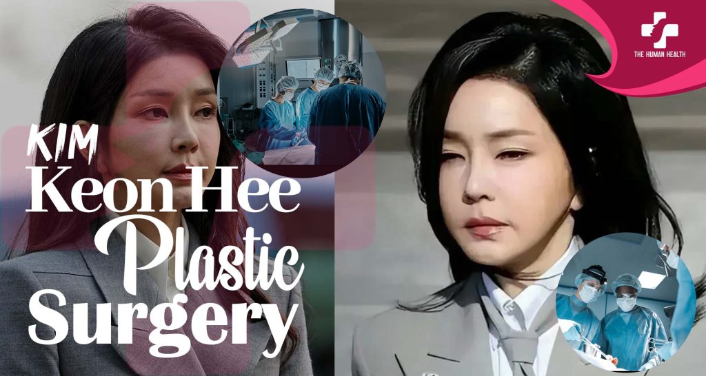 Kim Keon Hee Plastic Surgery Obsession: What Happened?
