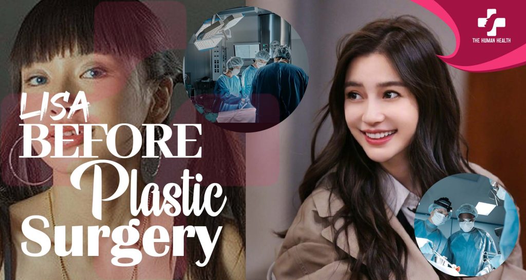 Lisa Before Plastic Surgery: Stunning Then & Now