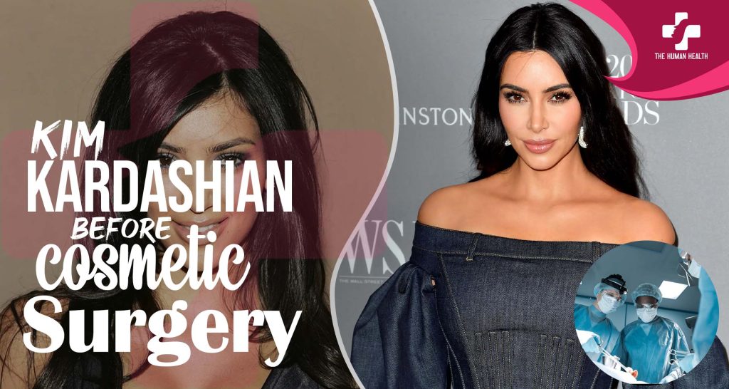 Kim Kardashian Before Surgery Exclusive Truth About?