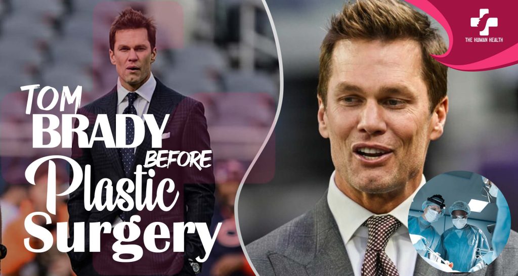 Tom Brady Before Plastic Surgery Revealed Now