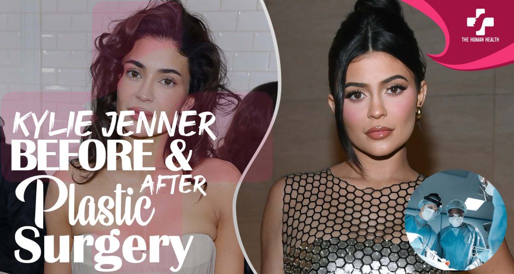 Kylie Jenner Plastic Surgery The Truth About.!