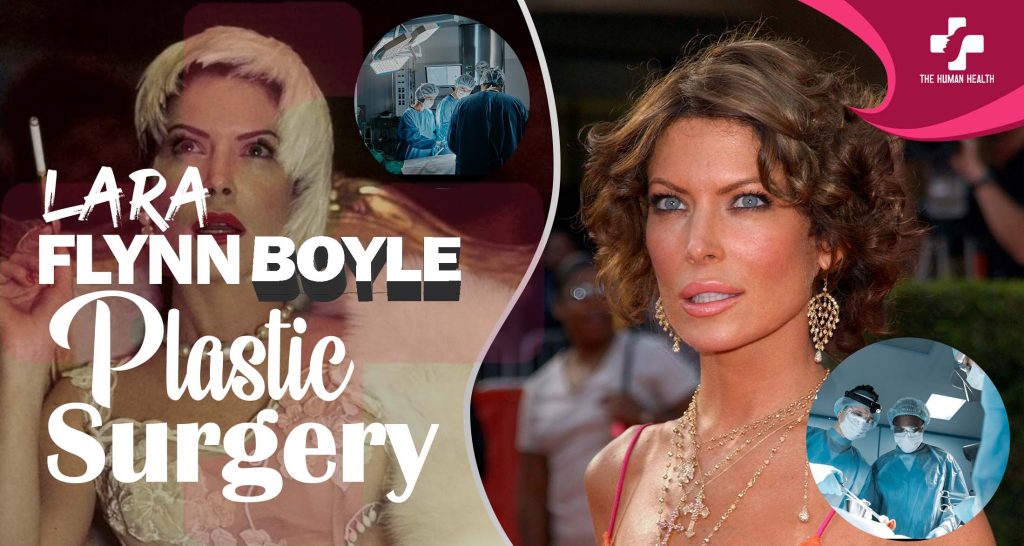 Lara Flynn Boyle Plastic Surgery Secrets Exposed