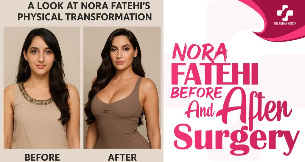 Nora Fatehi Before and After Surgery: Eye-Opening New Look