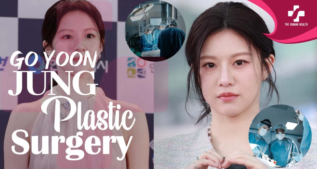 Go Yoon Jung Plastic Surgery Exposed: Shocking Secrets