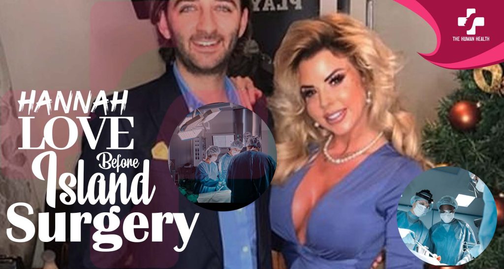 Hannah Love Island Before Surgery Exposed