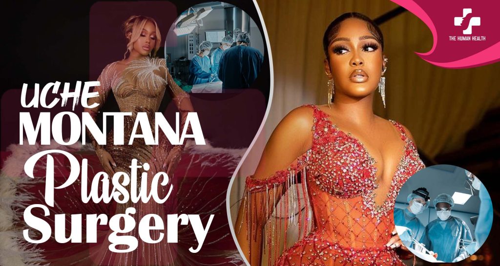 Uche Montana Surgery Secrets You Must Know