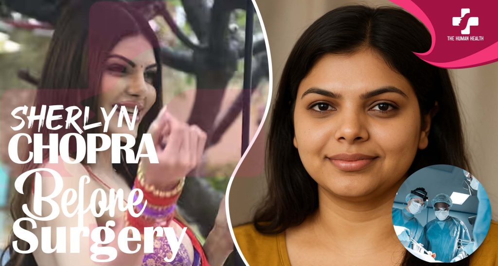 Sherlyn Chopra Before Surgery: Eye-Opening New Look