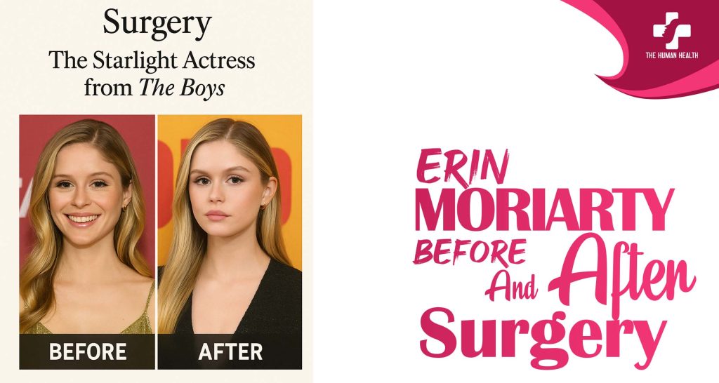 Erin Moriarty Before And After Surgery: Jaw-Dropping Secrets
