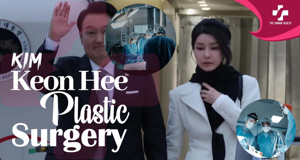 Kim Keon Hee Plastic Surgery Obsession: What Happened?
