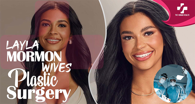Layla Mormon Plastic Surgery