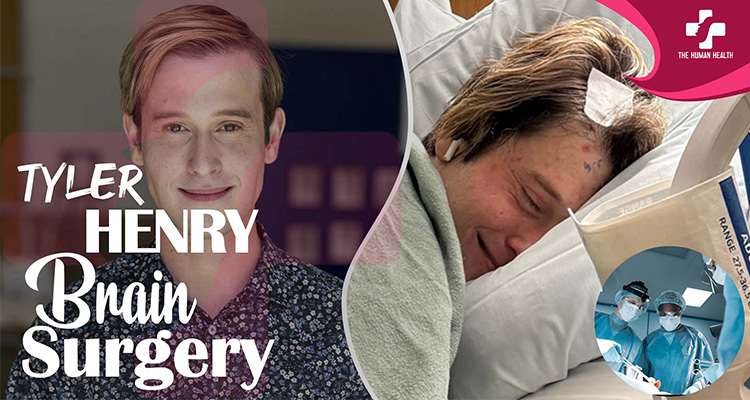 Tyler Henry Brain Surgery