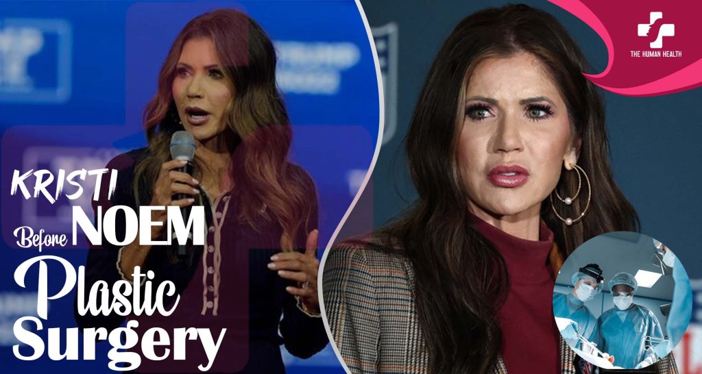 Kristi Noem Before Plastic Surgery: Exclusive, Eye-Opening Look