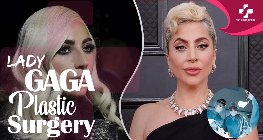 Lady Gaga Plastic Surgery: Eye-Opening New Look