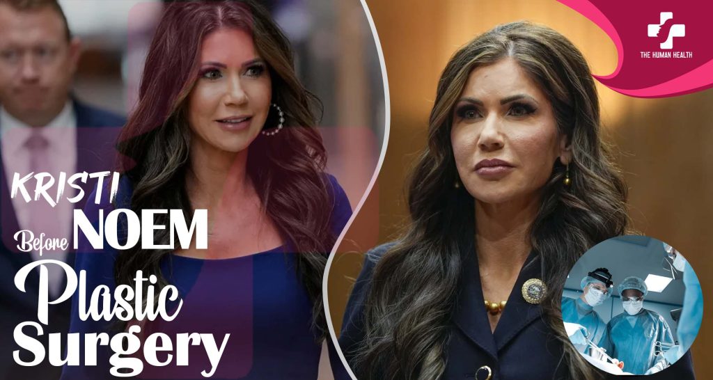 Kristi Noem Before Plastic Surgery: Exclusive, Eye-Opening Look