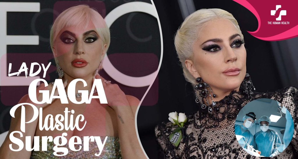 Lady Gaga Plastic Surgery: Eye-Opening New Look