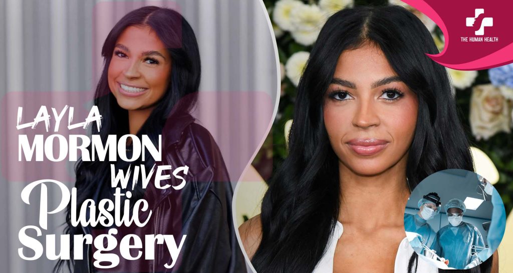 Layla Mormon Plastic Surgery: Exciting, Hidden, Verified