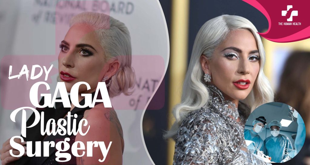 Lady Gaga Plastic Surgery: Eye-Opening New Look