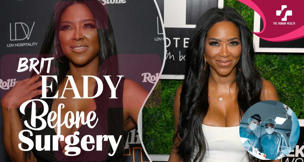Brit Eady Before Surgery: Exclusive, Eye-Opening Look