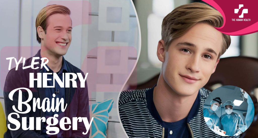 Tyler Henry Brain Surgery: Remarkable, Stunning Truth