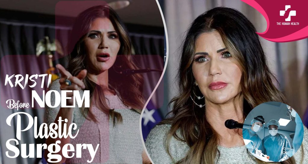 Kristi Noem Before Plastic Surgery: Exclusive, Eye-Opening Look