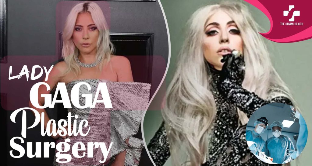 Lady Gaga Plastic Surgery: Eye-Opening New Look
