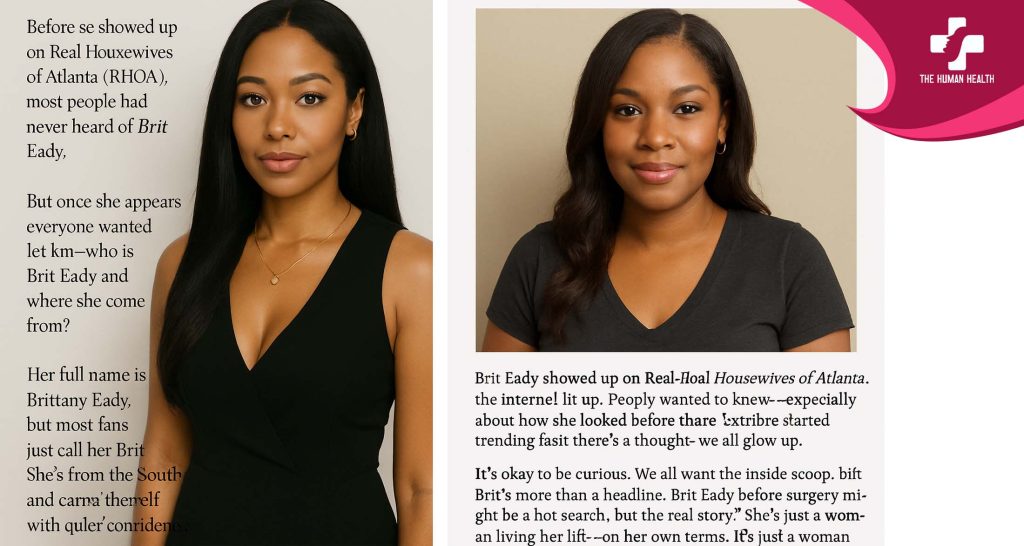 Brit Eady Before Surgery: Exclusive, Eye-Opening Look