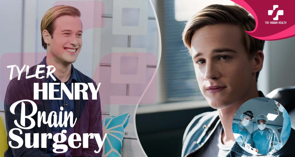 Tyler Henry Brain Surgery: Remarkable, Stunning Truth
