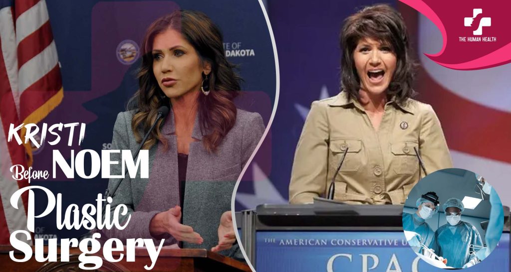 Kristi Noem Before Plastic Surgery: Exclusive, Eye-Opening Look