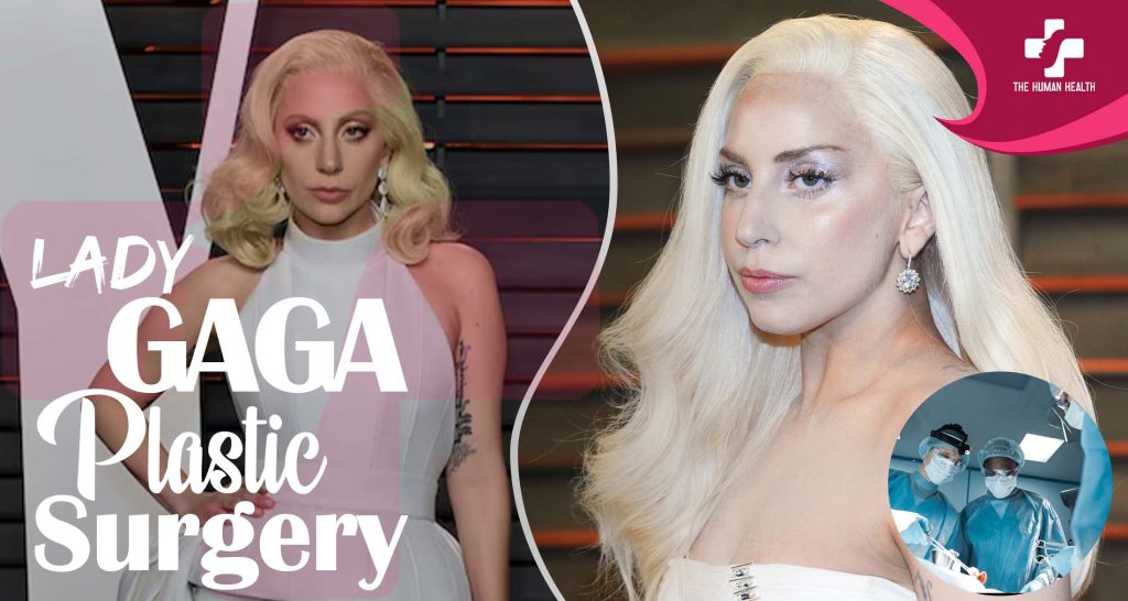Lady Gaga Plastic Surgery: Eye-Opening New Look