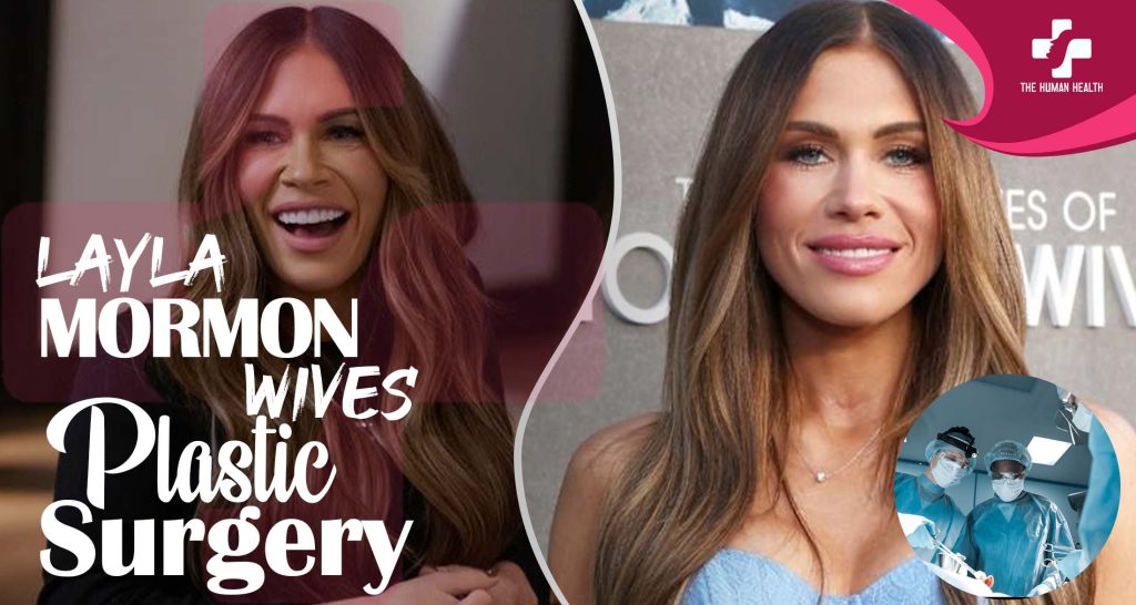 Layla Mormon Plastic Surgery: Exciting, Hidden, Verified