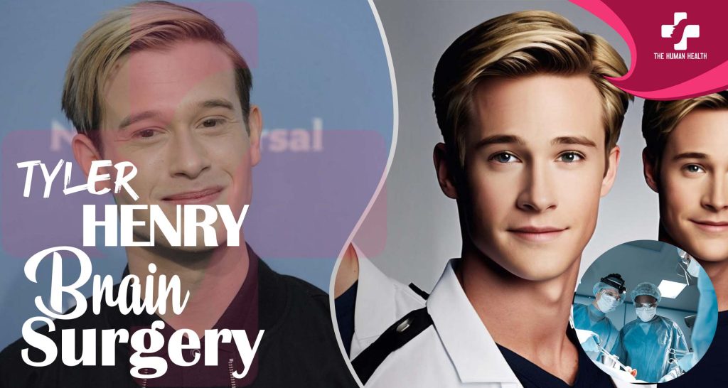 Tyler Henry Brain Surgery: Remarkable, Stunning Truth